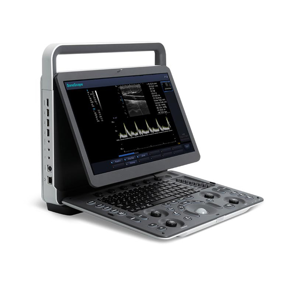 CONSERTO SONOSCAPE E1 GOIANIA