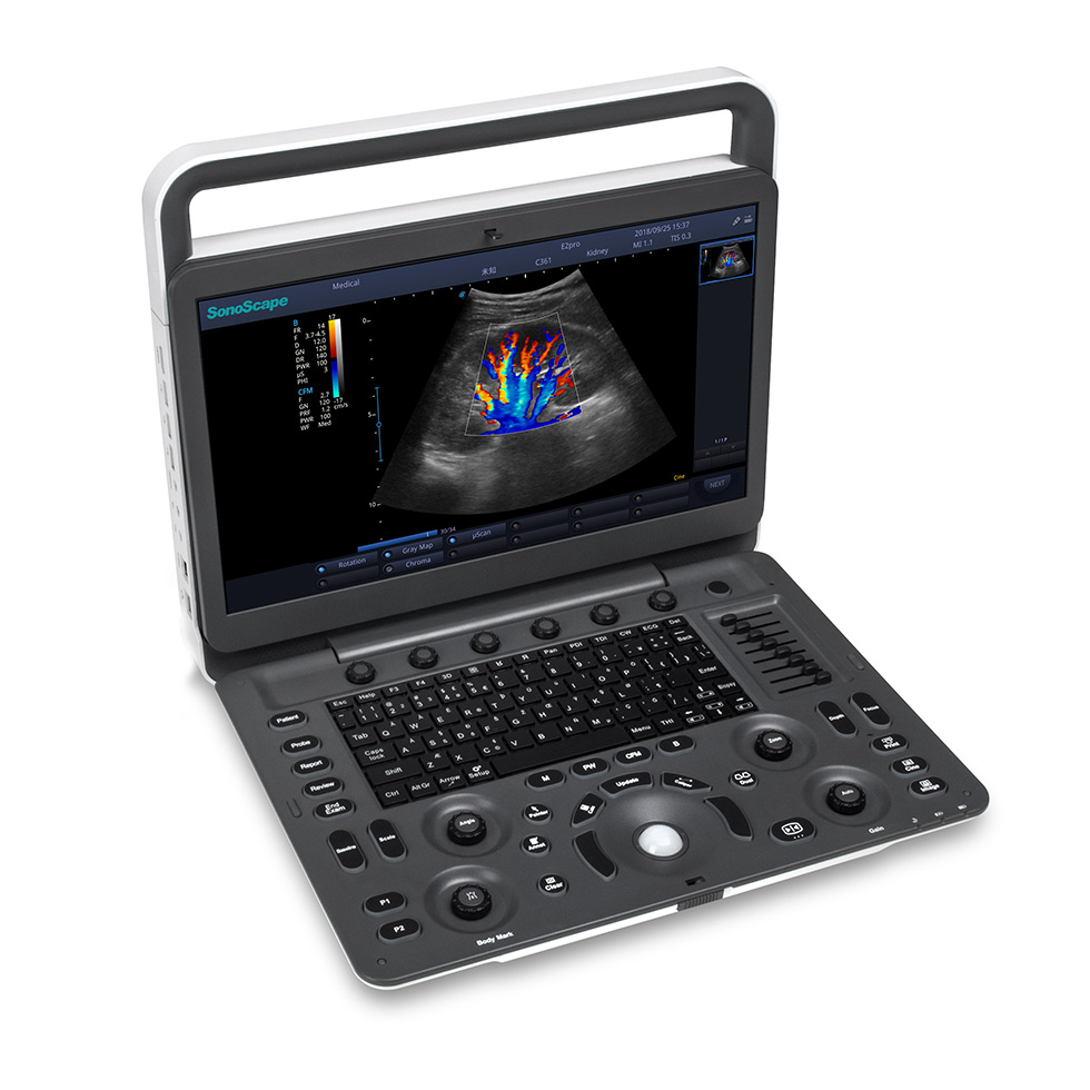 ULTRASSOM SONOSCAPE E2 BRASIL