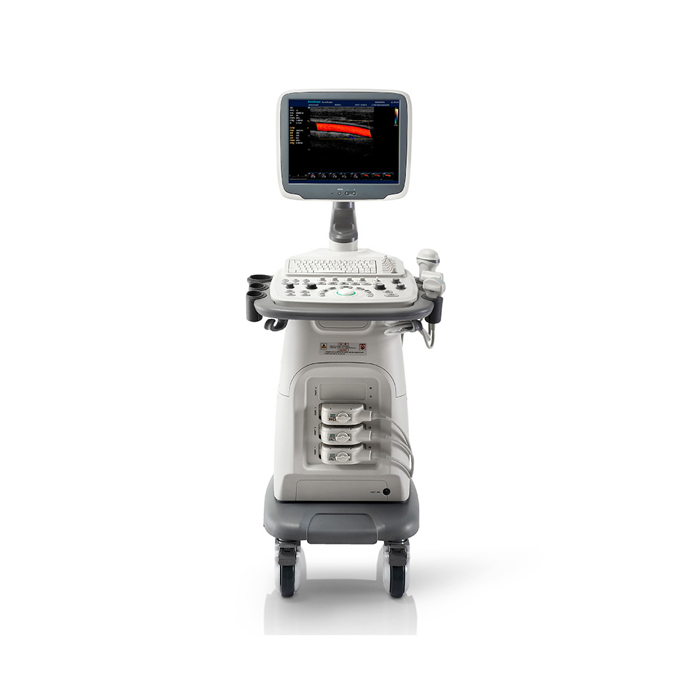 PLACA E PEÇAS SONOSCAPE S11 BRASIL